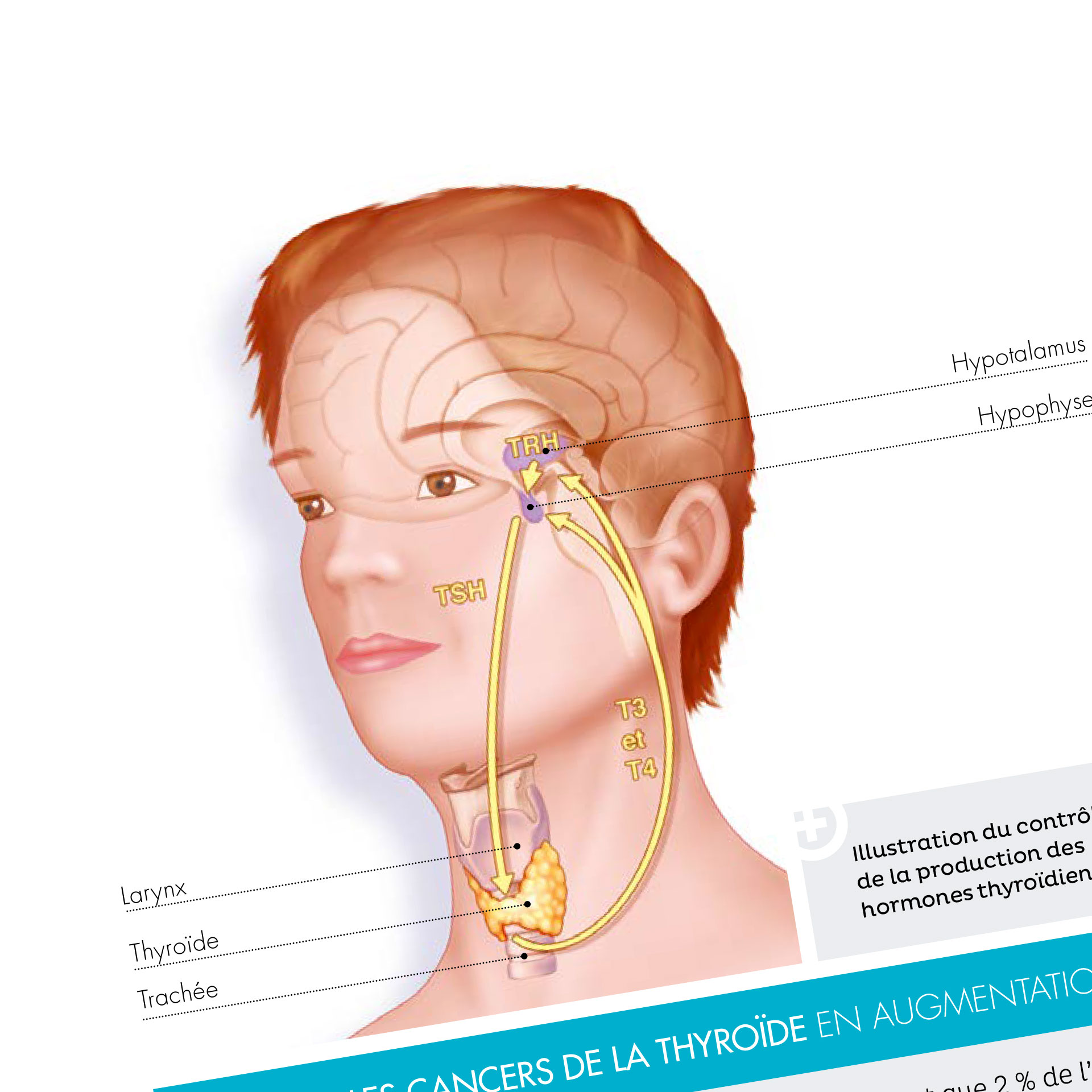 Zoom sur une illustration médicale, on y distingue le cerveau d'une personne ainsi que sa thyroïde.